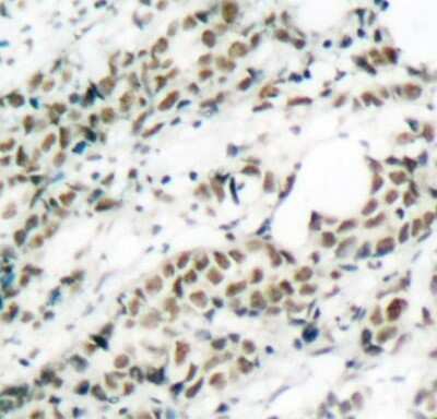 Immunohistochemistry-Paraffin: FOXO4 [p Ser197] Antibody - Azide and BSA Free [NBP3-05393]